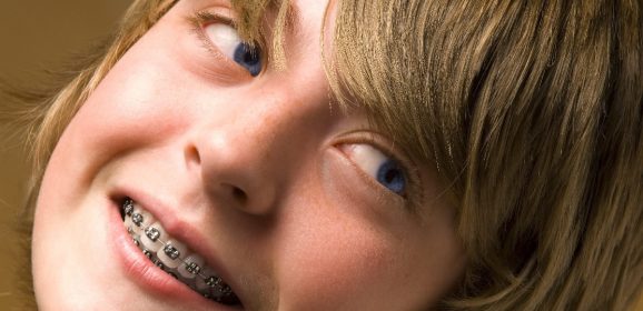 Ortodoncia para niños y adolescentes